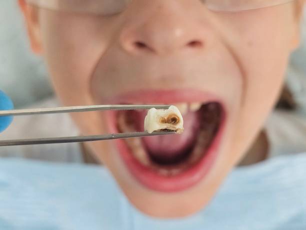 Best Broken or Cracked Tooth Emergency Dentist in Lakeview, GA